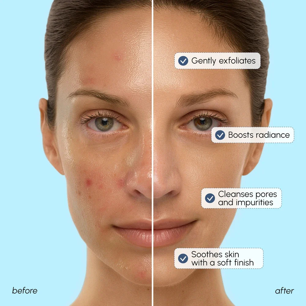 Face Polishing Scrub & Exfoliator